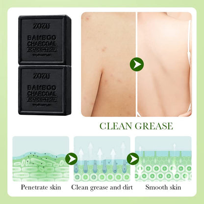 5 Pcs 100g Soap Bar Set for Hotel Guest Bathrooms – Product View 10